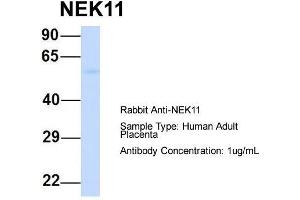 Western Blotting (WB) image for anti-NIMA (Never In Mitosis Gene A)-Related Kinase 11 (NEK11) (Middle Region) antibody (ABIN2783561)