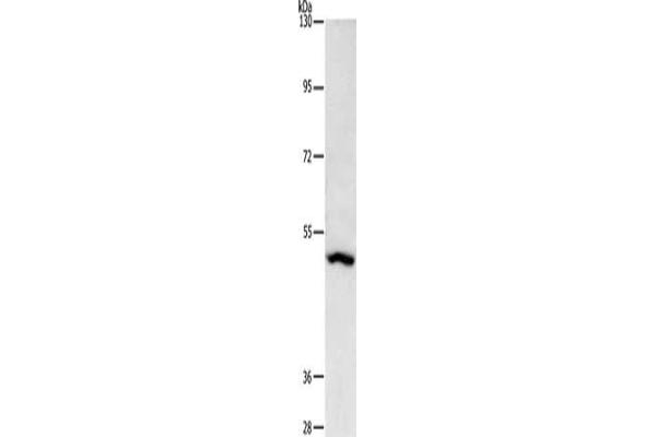 ASB1 antibody