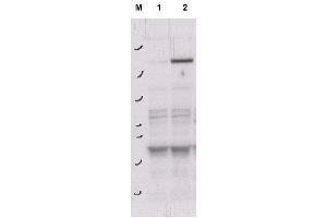Image no. 1 for anti-rho-Associated, Coiled-Coil Containing Protein Kinase 2 (ROCK2) (pTyr256) antibody (ABIN401393) (ROCK2 antibody  (pTyr256))