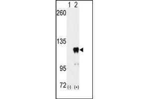 Image no. 3 for anti-Pumilio Homolog 2 (Drosophila) (PUM2) (Ser182) antibody (ABIN360017) (PUM2 antibody  (Ser182))
