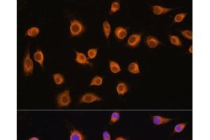 Immunofluorescence analysis of L929 cells using SLC20A1 Polyclonal Antibody at dilution of 1:100. (SLC20A1 antibody)