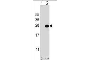 DGCR6L antibody  (AA 108-135)