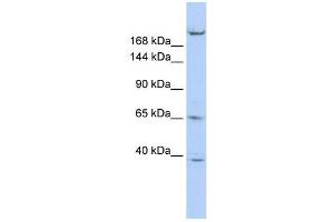 KIF13B antibody used at 1 ug/ml to detect target protein. (KIF13B antibody  (N-Term))