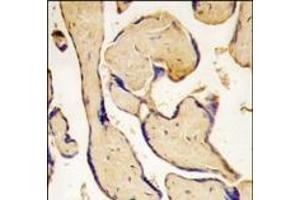 Immunohistochemistry (Paraffin-embedded Sections) (IHC (p)) image for anti-EPH Receptor A3 (EPHA3) (C-Term) antibody (ABIN359793)