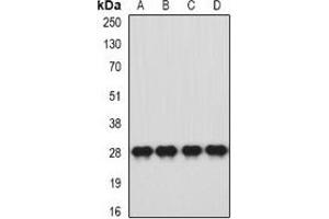 Western blot analysis of HLA-DQA1 expression in SW620 (A), HT29 (B), mouse brain (C), mouse stomach (D) whole cell lysates. (HLA-DQA1 antibody)