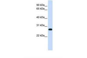 Image no. 1 for anti-Synaptosomal-Associated Protein, 23kDa (SNAP23) (AA 38-87) antibody (ABIN6738479) (SNAP23 antibody  (AA 38-87))