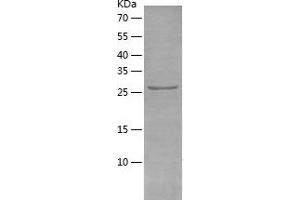 Western Blotting (WB) image for Haloacid Dehalogenase-Like Hydrolase Domain Containing 3 (HDHD3) (AA 1-251) protein (His tag) (ABIN7288586) (HDHD3 Protein (AA 1-251) (His tag))