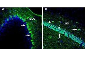 Expression of DPP10 in mouse cerebellum and hippocampusImmunohistochemical staining of perfusion-fixed frozen mouse brain sections with Anti-DPP10 (extracellular) Antibody (ABIN7043099, ABIN7045044 and ABIN7045045), (1:1000), followed by goat anti-rabbit-AlexaFluor-488. (Dipeptidylpeptidase 10 (DPP10) Peptide)