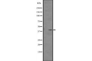 Western blot analysis of CSNK2A2 expression in Hela cell lysate,The lane on the left is treated with the antigen-specific peptide. (CSNK2A2 antibody  (N-Term))