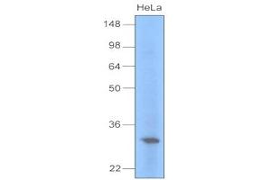 Western Blotting (WB) image for anti-Uracil-DNA Glycosylase (UNG) antibody (ABIN361167) (UNG antibody)