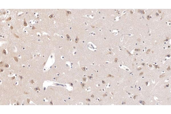 AGRP antibody  (AA 20-130)
