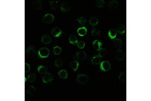 IHC analysis of CIAS1/NALP3 using anti-CIAS1/NALP3 antibody . (NLRP3 antibody  (N-Term))
