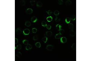 IHC analysis of CIAS1/NALP3 using anti-CIAS1/NALP3 antibody . (NLRP3 antibody  (N-Term))