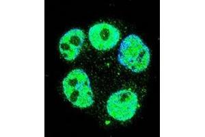 Confocal immunofluorescent analysis of METTL2 Antibody (C-term)(Cat#AP52675PU-N) with ZR-75-1 cell followed by Alexa Fluor 488-conjugated goat anti-rabbit lgG (green). (METTL2 antibody  (C-Term))