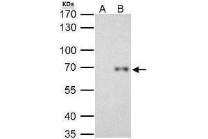 IP Image RelB antibody immunoprecipitates RelB protein in IP experiments. (RELB antibody  (C-Term))