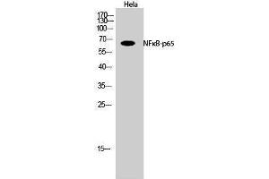 Western Blotting (WB) image for anti-Nuclear Factor-kB p65 (NFkBP65) (Thr735) antibody (ABIN3185891) (NF-kB p65 antibody  (Thr735))