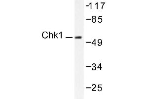 Image no. 1 for anti-Checkpoint Kinase 1 (CHEK1) antibody (ABIN265346) (CHEK1 antibody)