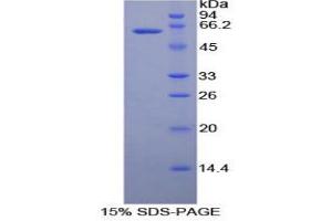 SDS-PAGE analysis of Human Ribonuclease T2 Protein. (RNASET2 Protein)