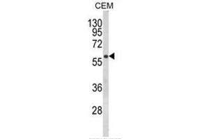 Western blot analysis of FLCN Antibody (Center) in CEM cell line lysates (35ug/lane). (FLCN antibody  (Middle Region))