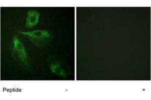 Immunofluorescence analysis of HeLa cells, using ADD1 polyclonal antibody . (alpha Adducin antibody)