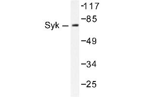 Image no. 1 for anti-Spleen tyrosine Kinase (SYK) antibody (ABIN271834) (SYK antibody)