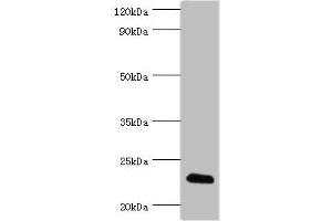 Western blot All lanes: FGF6 antibody at 10 μg/mL + HepG2 whole cell lysate Secondary Goat polyclonal to rabbit IgG at 1/10000 dilution Predicted band size: 23 kDa Observed band size: 23 kDa (FGF6 antibody  (AA 38-208))