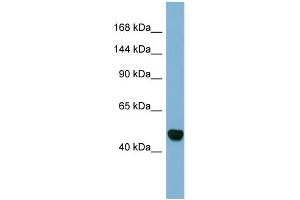Host:  Rabbit  Target Name:  MAML3  Sample Type:  Fetal Stomach lysates  Antibody Dilution:  1.