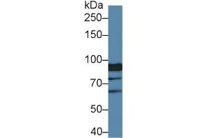 Detection of XYLT2 in Human Hela cell lysate using Polyclonal Antibody to Xylosyltransferase II (XYLT2) (XYLT2 antibody  (AA 596-865))