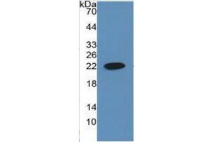 WB of Protein Standard: different control antibodies against Highly purified E. (CYFRA21.1 ELISA Kit)