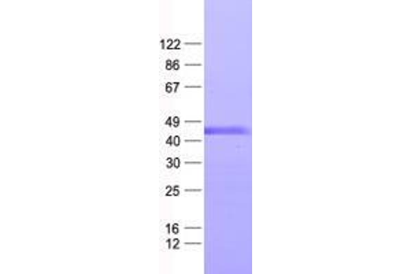 ZNF558 Protein (His tag)