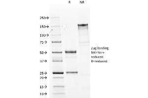 SDS-PAGE Analysis Purified Cytokeratin 14 Mouse Monoclonal Antibody (LL002). (KRT14 antibody  (C-Term))