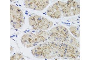 Immunohistochemistry of paraffin-embedded Human stomach using MTERFD3 Polyclonal Antibody at dilution of 1:100 (40x lens). (MTERFD3 antibody)