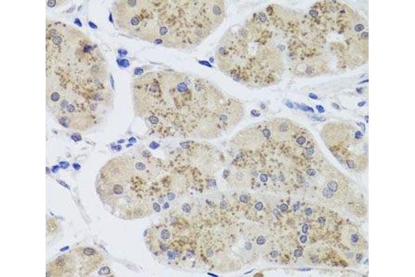 MTERFD3 antibody