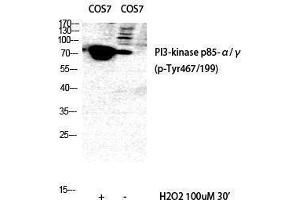 Western Blotting (WB) image for anti-Phosphoinositide 3 Kinase, p85/p55 (PI3K p85/p55) (pTyr199), (pTyr467) antibody (ABIN6288345) (PI3K p85/p55 antibody  (pTyr199, pTyr467))