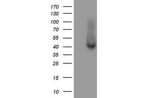 HEK293T cells were transfected with the pCMV6-ENTRY control (Left lane) or pCMV6-ENTRY TBCC (Right lane) cDNA for 48 hrs and lysed. (TBCC antibody)