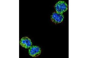 Confocal immunofluorescent analysis of MDA-MB435 cells using NFKBIL1  Antibody , followed by Alexa Fluor 488-conjugated goat anti-rabbit lgG (green). (NFKBIL1 antibody  (Middle Region))