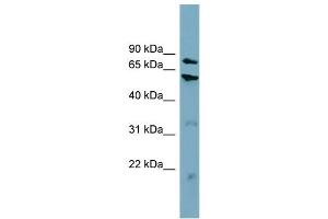 WB Suggested Anti-CPT1B  Antibody Titration: 0.