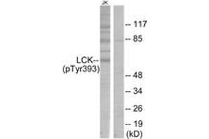 Western blot analysis of extracts from Jurkat cells, using Lck (Phospho-Tyr393) Antibody.