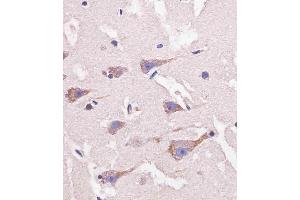 D staining Nestin in human brain tissue sections by Immunohistochemistry (IHC-P - paraformaldehyde-fixed, paraffin-embedded sections). (Nestin antibody  (AA 1389-1416))