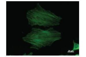 Immunostaining analysis in HeLa cells. (beta Actin antibody)