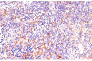Immunohistochemistry of paraffin-embedded Mouse spleen using ROCK1 Polyclonal Antibody at dilution of 1:100 (40x lens). (ROCK1 antibody)