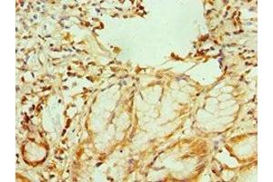 Immunohistochemistry of paraffin-embedded human gallbladder tissue using ABIN7151755 at dilution of 1:100 (GATA2 antibody  (AA 1-300))