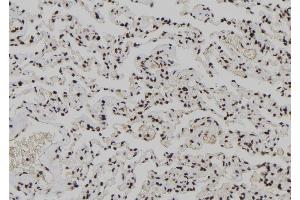 ABIN6278212 at 1/100 staining Human lung tissue by IHC-P. (XPO4 antibody  (N-Term))