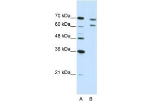 Western Blotting (WB) image for anti-Cleavage and Polyadenylation Specific Factor 3, 73kDa (CPSF3) antibody (ABIN2462266) (CPSF3 antibody)