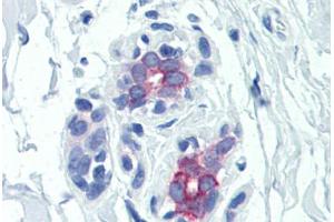 Human Breast (formalin-fixed, paraffin-embedded) stained with PRLR antibody ABIN351557 at 5 ug/ml followed by biotinylated goat anti-rabbit IgG secondary antibody ABIN481713, alkaline phosphatase-streptavidin and chromogen. (Prolactin Receptor antibody)