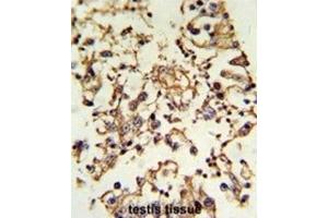 Immunohistochemistry (IHC) image for anti-Protein Kinase A, alpha (PRKACA) antibody (ABIN3002818) (PRKACA antibody)