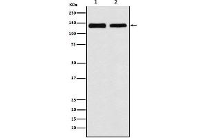Western blot analysis of UBE4B expression in (1) 293T cell lysate, (2) NIH/3T3 cell lysate.