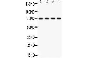 KCNMA1 anticorps  (AA 124-467)