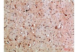 Immunohistochemical analysis of paraffin-embedded human-brain, antibody was diluted at 1:200 (NLRX1 antibody  (AA 581-630))
