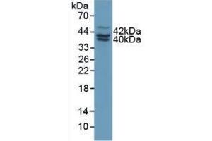 Detection of PAI2 in Human MCF7 Cells using Polyclonal Antibody to Plasminogen Activator Inhibitor 2 (PAI2) (SERPINB2 antibody  (AA 154-408))